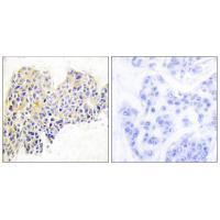 HSP90B (Ab-254) Antibody