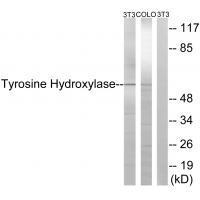 Tyrosine Hydroxylase (Ab9) Antibody