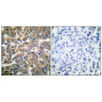 GR (Ab-211) Antibody