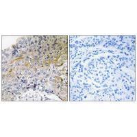 p130 Cas (Ab-410) Antibody