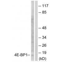 4E-BP1 (Ab-64) Antibody