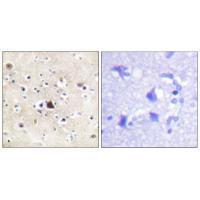 GR (Ab-226) Antibody