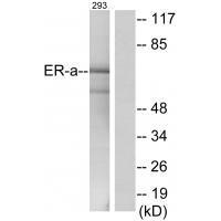 Estrogen Receptor-α (Ab-537) Antibody