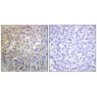 FGFR1 (Ab-766) Antibody