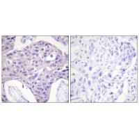 FOXO1/3/4-pan Antibody