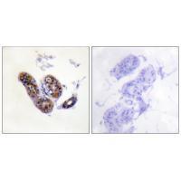 MITF (Ab80/73) Antibody