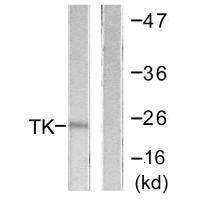 TK (Ab3) Antibody