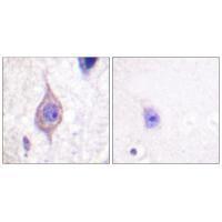 ALK Antibody