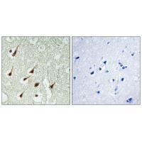 PKC θ Antibody