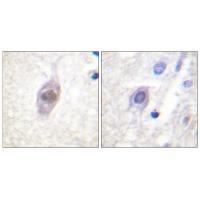 APC Antibody
