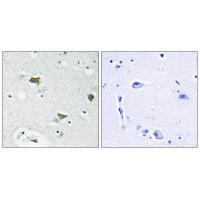 BAD Antibody