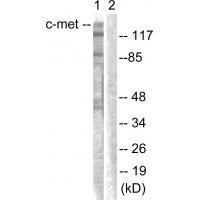 c-Met (Ab003) Antibody