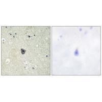 CSFR (Ab-809) Antibody