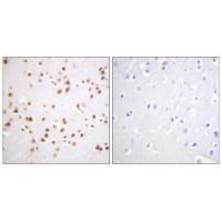 Catenin-δ1 (Ab-228) Antibody
