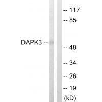 DAPK3 (Ab-265) Antibody