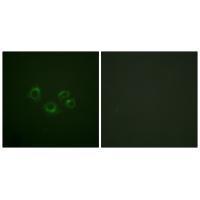 EPHA2/3/4 (Ab-588/596) Antibody