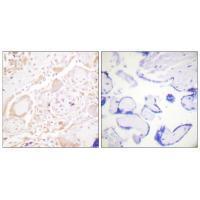 GATA3 Antibody