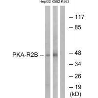 PKA-R2β (Ab13) Antibody