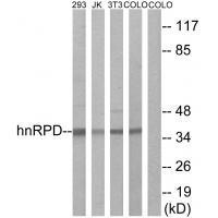 hnRPD (Ab-83) Antibody