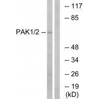 PAK1/2 (Ab99) Antibody