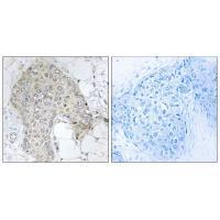 PPP1R2 (Ab20/121) Antibody