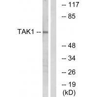 TAK1 (Ab84) Antibody