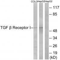 TGF β Receptor I (Ab65) Antibody