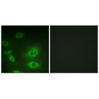 ATP1α1/Na+K+ ATPase1 (Ab-23) Antibody