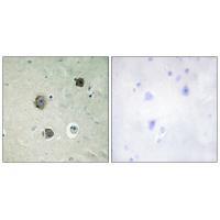 CDK5 (Ab5) Antibody
