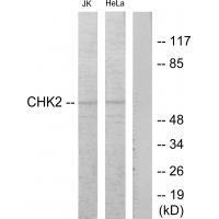 Chk2 (Ab-68) Antibody