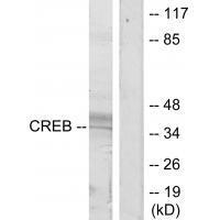 CREB (Ab29/133) Antibody