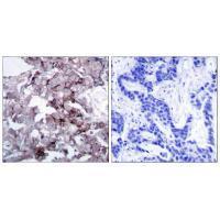 EGFR (Ab172) Antibody