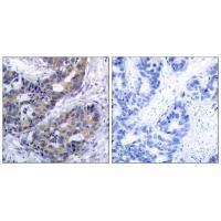 IRS (Ab-312) Antibody