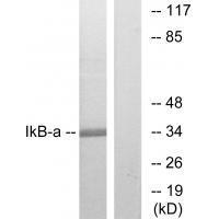 IκB-α (Ab-32/36) Antibody