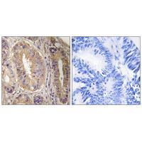 FAK (Ab-843) Antibody