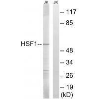 HSF1 (Ab21) Antibody