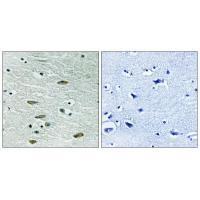 IGF1R (Ab346) Antibody