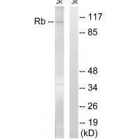 Retinoblastoma (Ab-608) Antibody