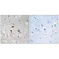 ALK Antibody