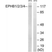 EPHB1/2/3/4 (Ab-600/602/614/596) Antibody