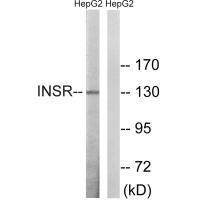 INSR (Ab375) Antibody