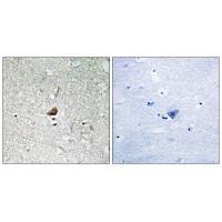 IRAK1 Antibody