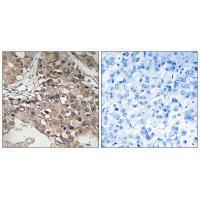 MAP3K7 (Ab87) Antibody