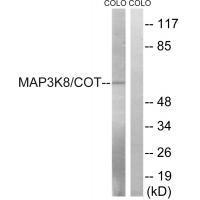MAP3K8 (Ab-400) Antibody