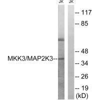 MAP2K3 (Ab-222) Antibody