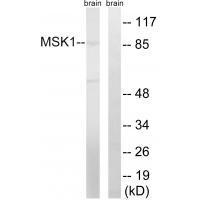 MSK1 (Ab-212) Antibody