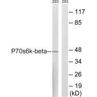 p70 S6 Kinase β (Ab-423) Antibody