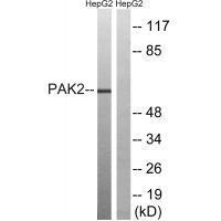 PAK2 (Ab92) Antibody