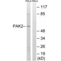 PAK2 (Ab41) Antibody