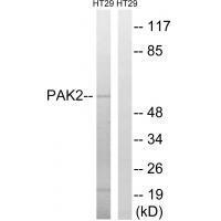 PAK2 (Ab97) Antibody